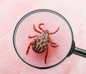 Lyme Disease